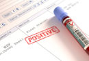 È ancora emergenza HIV: scarsa informazione, pochi test e tanto stigma