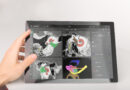 Impianti cocleari: MED-EL riceve il premio Hearing Technology Innovator per OTOPLAN Impianti cocleari: MED-EL riceve il premio Hearing Technology Innovator per OTOPLAN