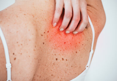 Tumori della pelle: l’allarme dei dermatologi sui ritardi che compromettono le cure